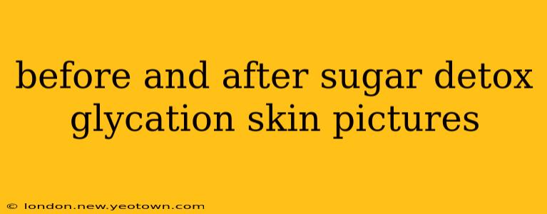 before and after sugar detox glycation skin pictures