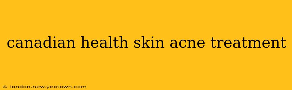 canadian health skin acne treatment