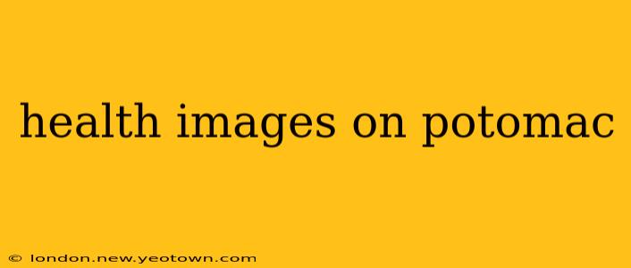 health images on potomac