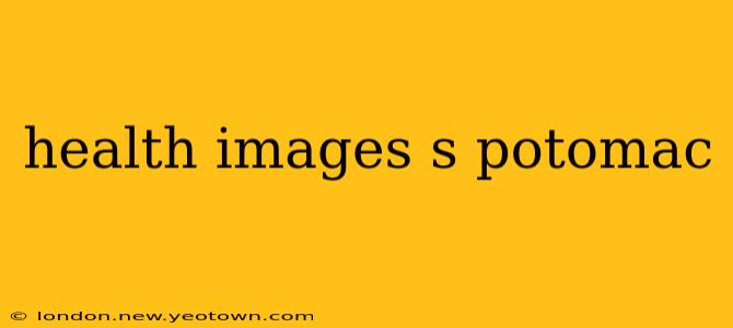health images s potomac
