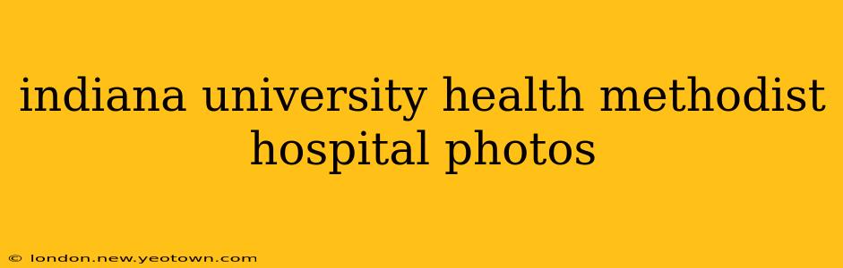 indiana university health methodist hospital photos